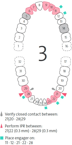 ToothChart.gif