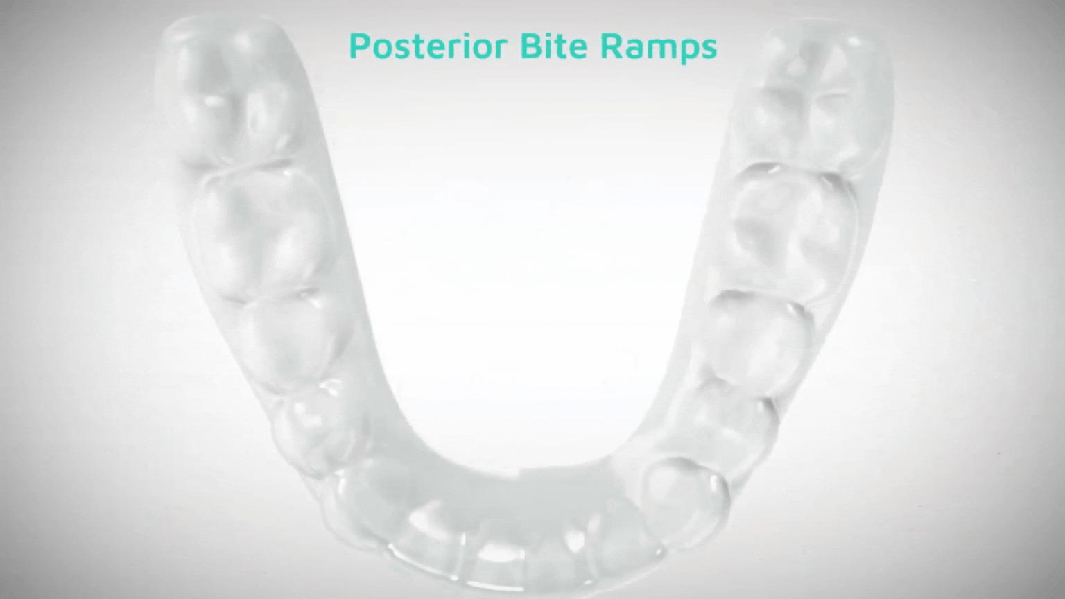 Corte posterior 3 (1).gif