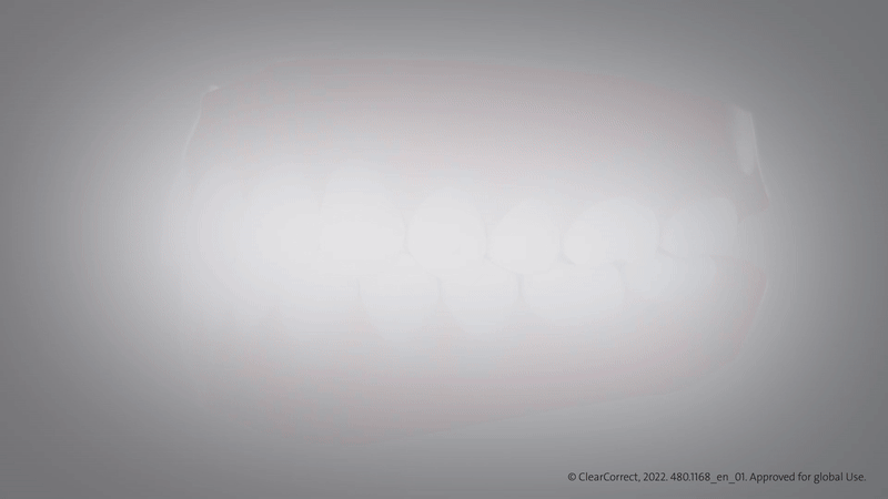 Vcc.1168_en_01_Vertical_Engager-ezgif.com-video-to-gif-converter.gif