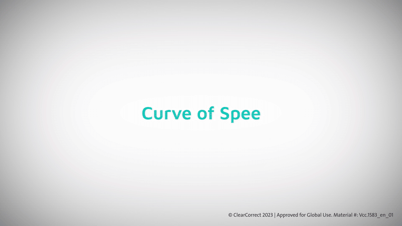 Vcc.1583_en_01_CurveofSpee-ezgif.com-video-to-gif-converter.gif