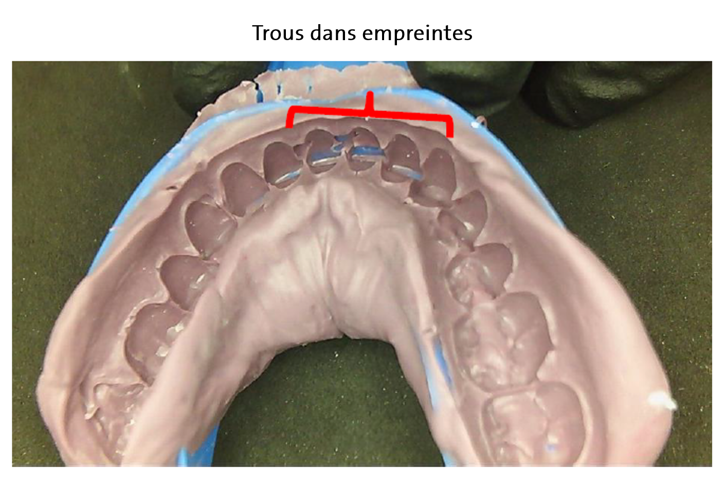 Holes_in_impression_FR.png
