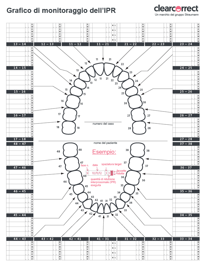 IPR_Tracking_Chart_IT.PNG