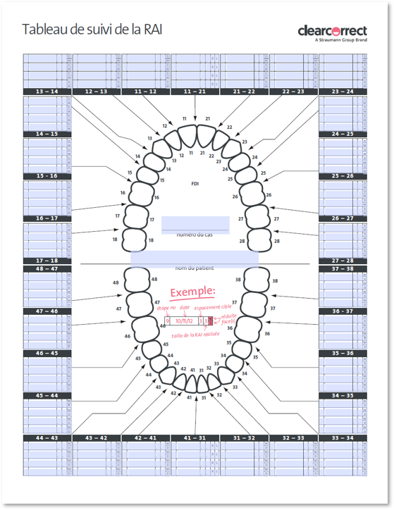 IPR_Tracking_Chart_FR.PNG