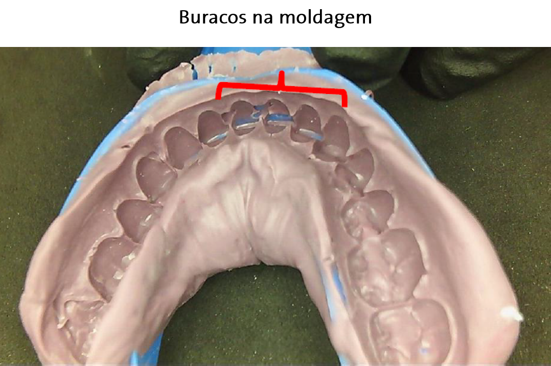 Holes_in_impression_PT_BR.png