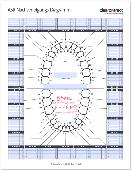 IPR_tracking_chart_-_DE.png