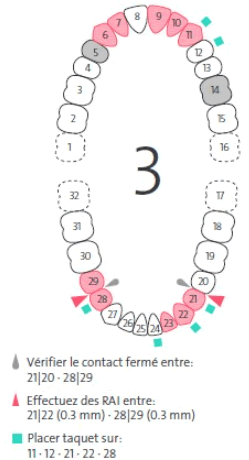FR213781857_1.gif