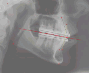 4403065856407_33.gif