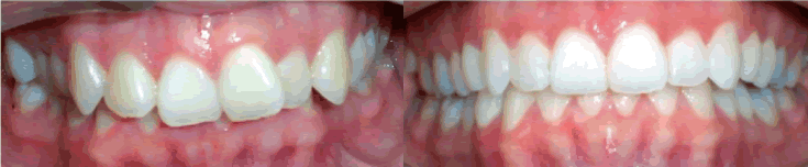 4403065856407_52.gif