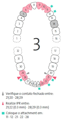 PT_BR_ToothChart.gif