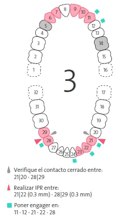 ES_ES_ToothChart.gif