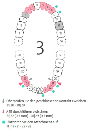 DE_ToothChart.gif