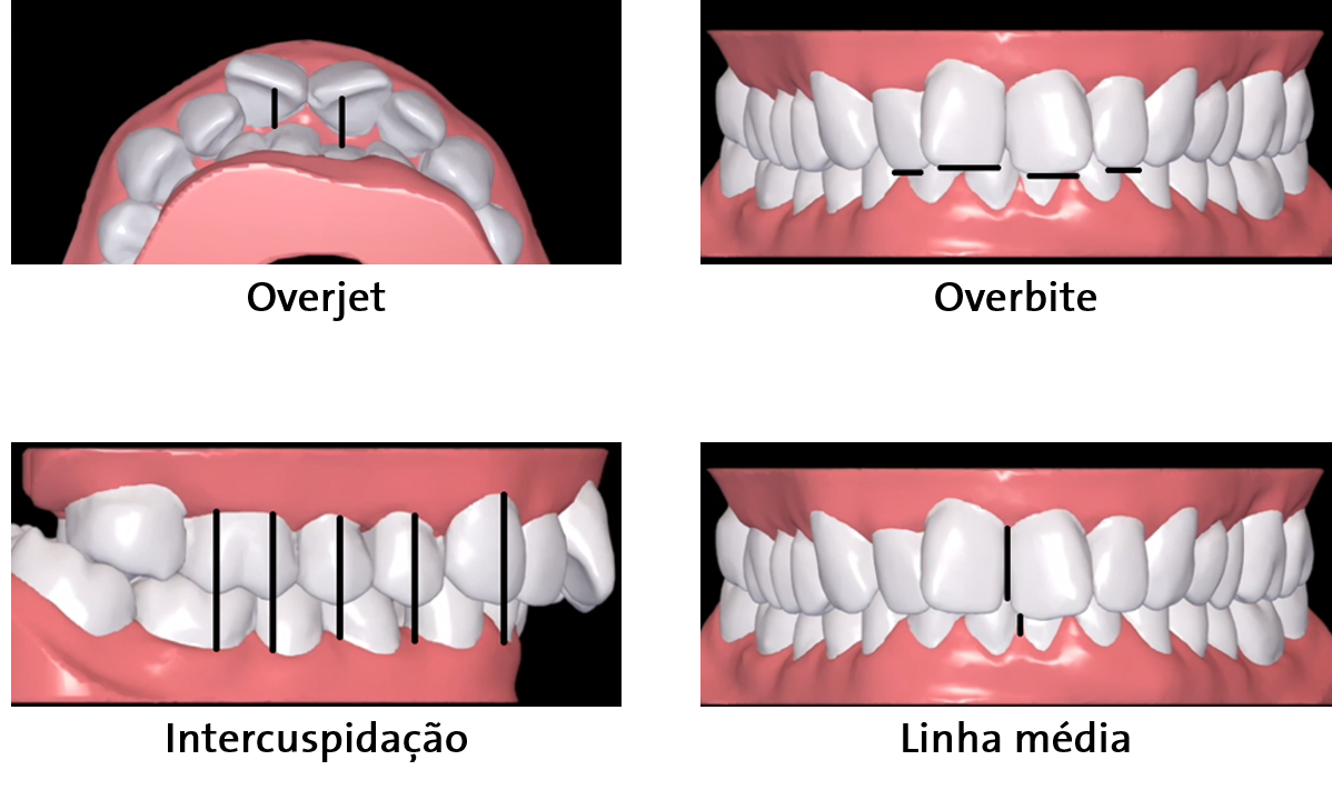Treatment_setup_-_compare_-_all_-_PT_BR.png