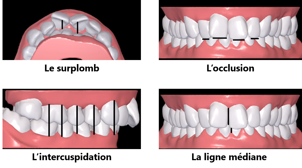 Treatment_setup_-_compare_-_all_-_FR.png